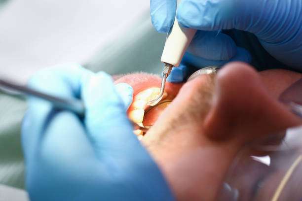 Best Emergency Care for Gum Disease in Marbleton, WY